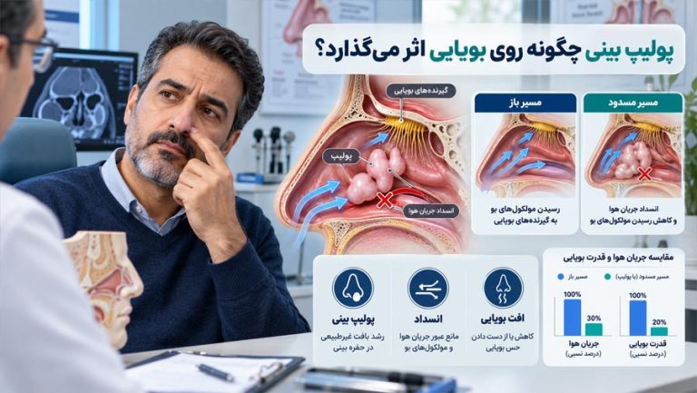 کاهش بویایی در سینوزیت
