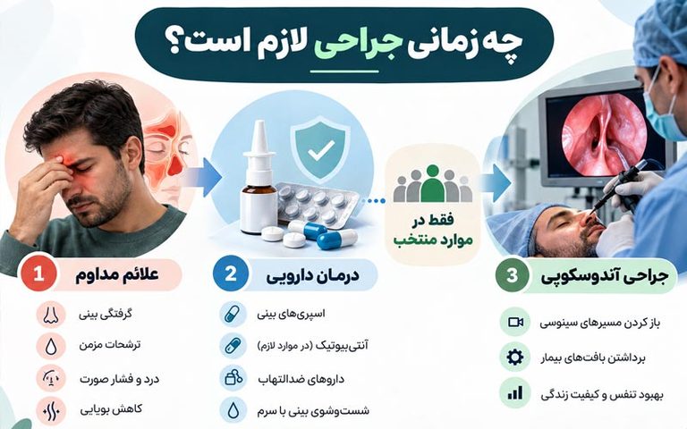 چه زمانی جراحی سینوزیت لازم است؟