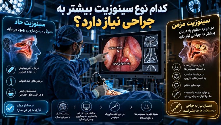 کدام نوع سینوزیت بیشتر به جراحی نیاز دارد؟