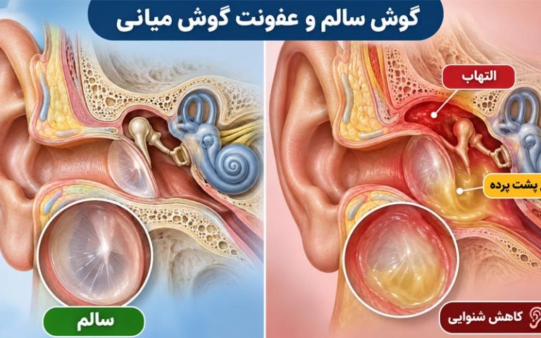 گوش سالم و عفونت گوش میانی