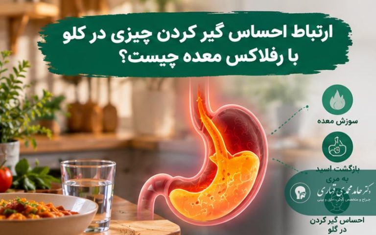 گیرکردن در گلو و ریفلاکس معده