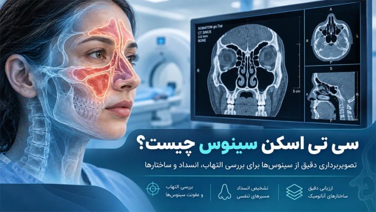 سی تی اسکن سینوس چیست؟