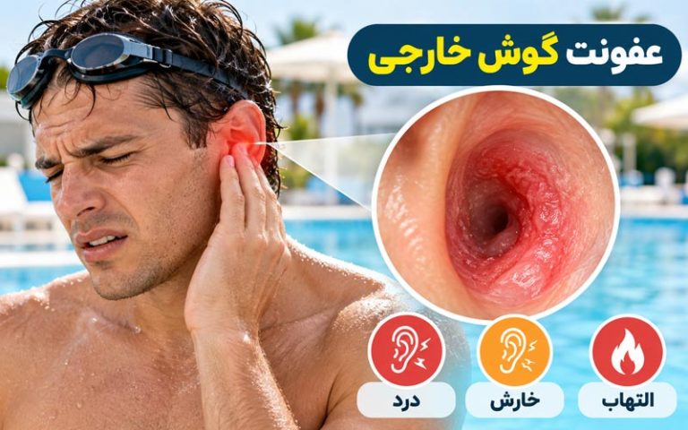 عفونت گوش خارجی
