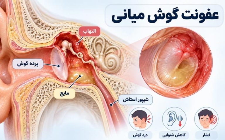 عفونت گوش میانی چیست